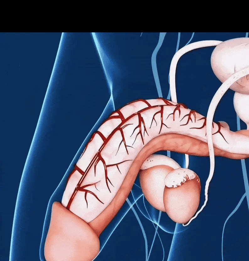 AlphaPulse® 5-in-1 Shockwave Therapy Device 16 Gif ezgif.com optimize 800x 19d9449c f102 47e0 b401 78b0813247b7